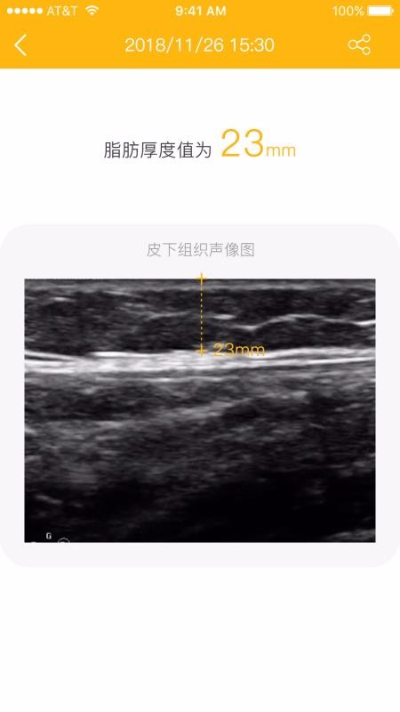 ֬�������