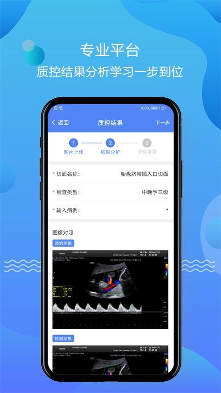 ǿֻapp-ǿ v1.0.8 ׿